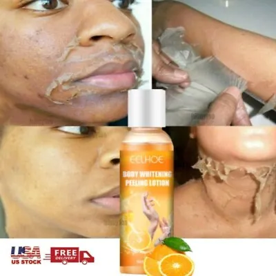 $9.95 • Buy Orange Peeling Lotion Body Whitening Cream Lightening Brightening Skin Bleaching