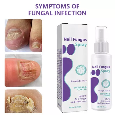 1x3x Instant Effective Medinail Fungus Repair Spray Treatment For Toenail Nail • £12.49