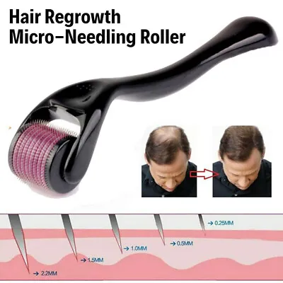 £2.39 • Buy Hair Regrowth Micro-Needling Roller Stimulates Hair Growth 540 Titanium Painless