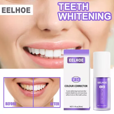 Hismile V34 Whitening Toothpaste Colour Corrector Teeth Stain Removal Gel Purple • $10.95