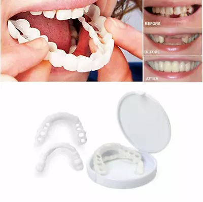 $15.99 • Buy Dentures Temporary Replacement Tooth Kit For Top Or Bottom Missing Teeth