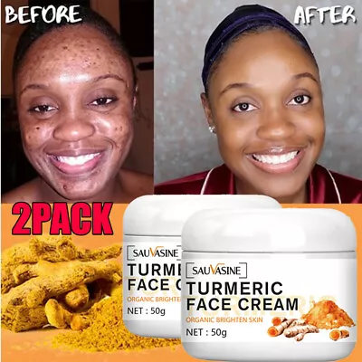 2x Turmeric Cream Serum Dark Spot Corrector Skin Melasma Remove Wrinkles Serum • $13.45