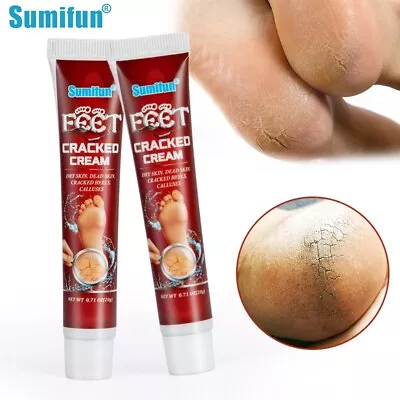 New Feet Hand Chaps Ointment Herbal Cracked Heel Winter Peeling Callus Dead Skin • £4.67