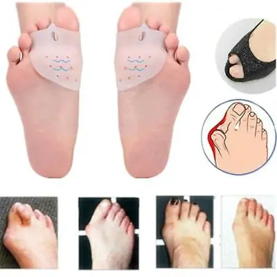 1 Pair Pain Relief Orthotics Bunion Gel Toe Separator Hammer Toe Forefoot Pads • $1.98