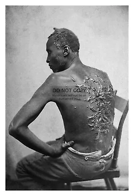 African American Slave Enslaved Mans Scarred Back 1863 4x6 Photo • $7.97