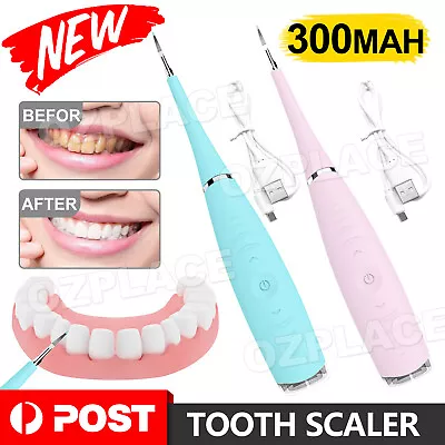 Electric Tooth Cleaner Ultrasonic Dental Scaler Tartar Plaque Calculus Remover • $13.85