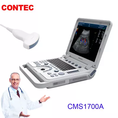 Color Doppler Vascular Ultrasound Scanner With 3.5mhz Abdominal  Probe Battery • $3989