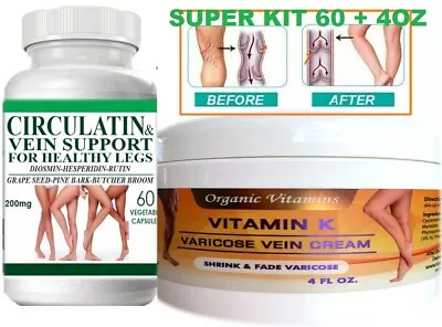 LEG VEIN & CIRCULATION Varicose Veins Spider Veins Blood Circulation KIT  • $17.10