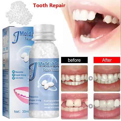 Temporary Tooth Repair Kit Teeth Gaps False Teeth Solid Glue Denture Adhesive • £4.31