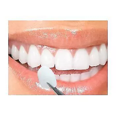 100pcs Dental Componeer Thin Whitening Resin Veneer Upper Anterior Teeth  • $6.99