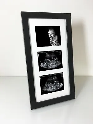 Triple Pregnancy Ultrasound Scan & 1st Photo Hand Made Black Frame • £15.95