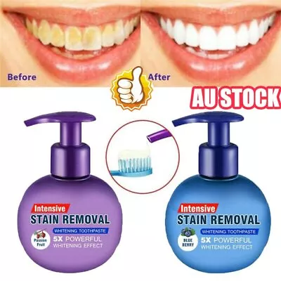 $7.98 • Buy Instant Clean Intensive Stain Removal Whitening Toothpaste Fight Bleeding Gums ~