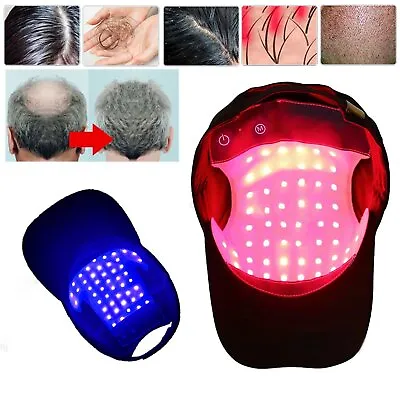 660/850nm Hair Growth Regrowth Helmet Reduce Hair Loss LED Hair Fast RegrowthCap • $36.79