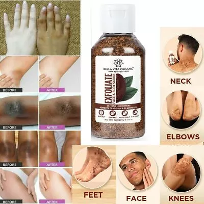 $24.85 • Buy Coffee Scrub For Face Body Neck Knees Blackhead Remover Tan Dirt Removal 75gm