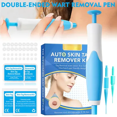 2in1 Painless Auto Skin Tag Mole Wart Removal(40x Rubber Bands + Alcohol Pads) • $10.98