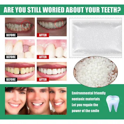 Teeth Glue Falseteeth Solid Glue Resin FalseTeeth Teeth Gap Denture Filling UK # • £3.07