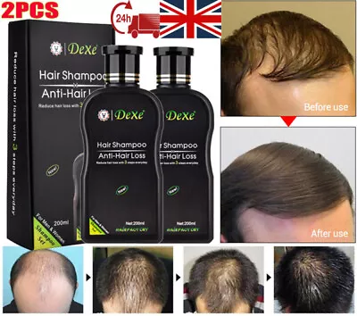 2PCS Dexe Fast Hair Growth Shampoo Anti Hair Loss Hair Thickening For Women Men • £12.96