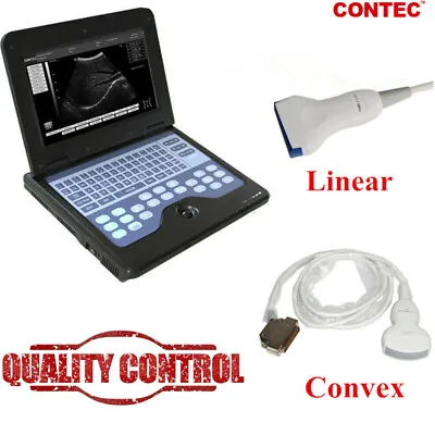 Digital Portable Ultrasound Machine Laptop Scanner + 2 Probes (Convex + Linear) • $1516.99