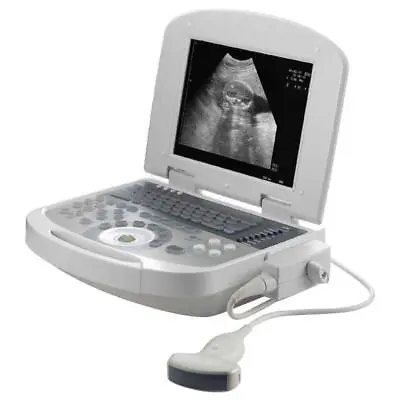 Handheld Digital Ultrasound Machine For Medical Use - Convex Probe SALE! • $1799