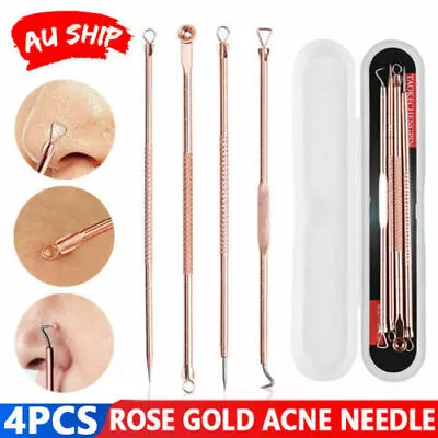 $4.86 • Buy 4Pcs Blackhead Remover Tool Pimple Acne Popper Blemish Comedone Cleaner Kit 1