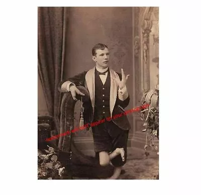 Vintage Creepy Lobster Boy PHOTO Scary Sideshow Circus Freak Boy • $4.38