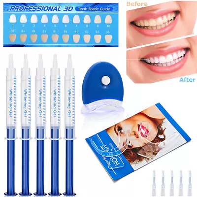 Teeth Whitening Gel Set Strong Teeth Whitening Bleach Dental Extra White Kit / • $15.59