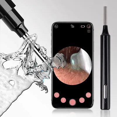 HD Ear Wax Remover Camera Wireless Ear Endoscope Spoon Pick Cleaning Otoscope UK • £11.24