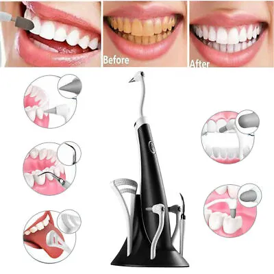 $15.95 • Buy 5In1 Tooth Polishing Cleaner Ultrasonic Electric Oral Teeth Cleaning Kit Dental