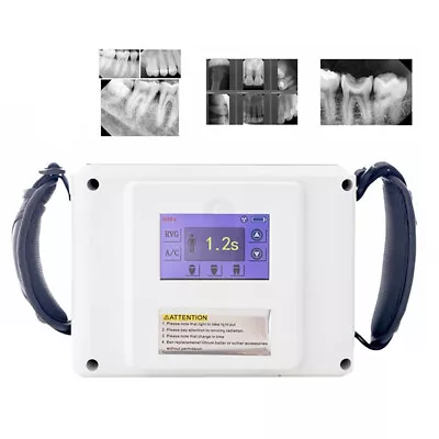 Touch Screen Dental X Ray Camera Machine High Frequency Imaging System Supplier • $738.99