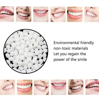 5g Temporary Tooth Repair Kit Teeth And Gaps False Teeth Solid Glue • £0.10