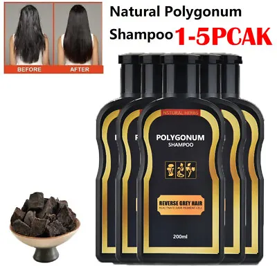 5x 200ml Reverse Grey Hair Darkening Shampoo Natural Polygonum Essence Hair Care • £7.95