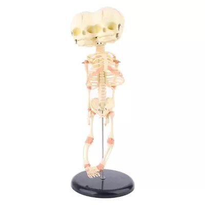 Human Baby Deformed For Head Skull Research Model Skeleton Anatomical Brain Anat • £35.44