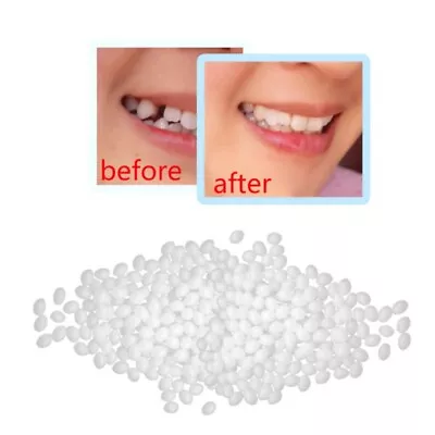 50g Temporary Tooth Repair Thermal Beads For Fix The Missing And Broken Tooth  • $7.88