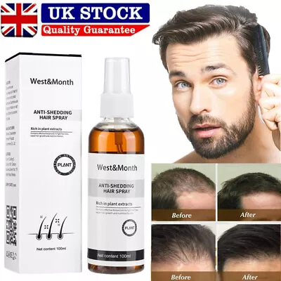 Hair Growth Spray Hair Regrowth Treatment Anti-Hair Loss For Men Women 100ml • £5.95