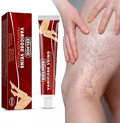 Vein Smoothing Varicose Vein Cream Varicose Veins Cream For Legs • £3.79