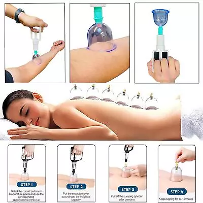 12PCS Cupping Therapy Set Vaccuum Massage Cups Health Acupunture Suction UK • £8.99