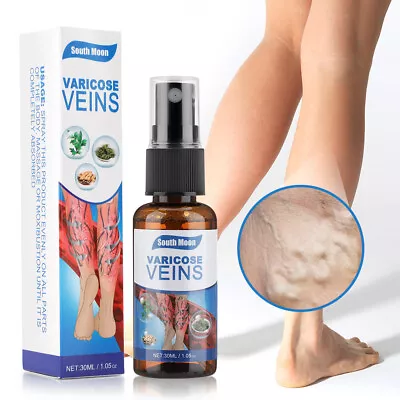 Varicose Veins Cream Relief Phlebitis Angiitis Varices Inflammation Care Spray U • $8.78
