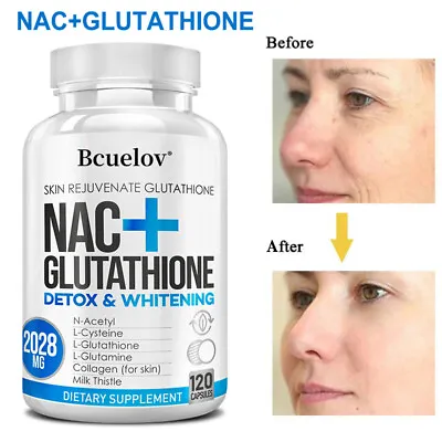 NAC N-Acetyl-Cysteine + Glutathione 120 Capsules 2028mg | Antioxidant Supplement • £8.96