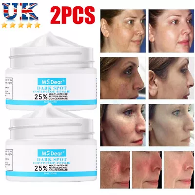 2 X Strong Removal Melasma Whitening Cream Freckle Speckle Spots Melanin Pigment • £9.45