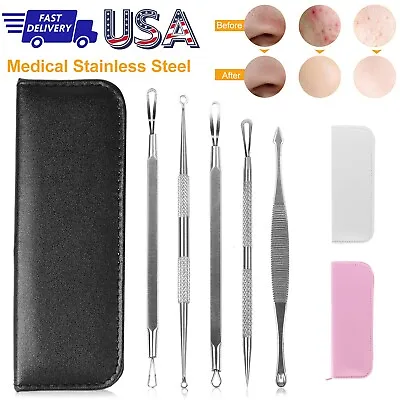 $6.97 • Buy Pimple Popper Blackhead Remover Kit Dr Tool Comedone Zit Extractor Doctor Best