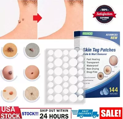 144pcs Skin Tag Remover Patches Quick Effective Mole Wart Removal Pad Sticker US • $7.64