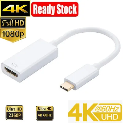 $9.99 • Buy USB C Multiport Adapter Thunderbolt 3 Type C To HDMI 4K VGA DVI Cable Macbook AU