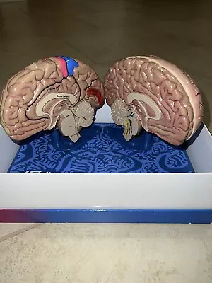 Merck Maxalt Brain Model  An Inside Look At Migraine  Migraine Headache Display • $100