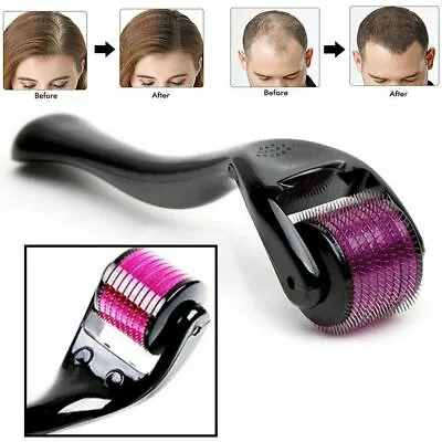 Microneedle 540 Derma Titanium Roller For Hair Beard Regrowth Anti-hair Loss • $3.89