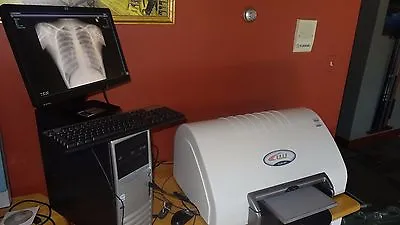 Chiropractic Digital Xray Cr Reader With Warranty Nucca Software X-ray • $8400