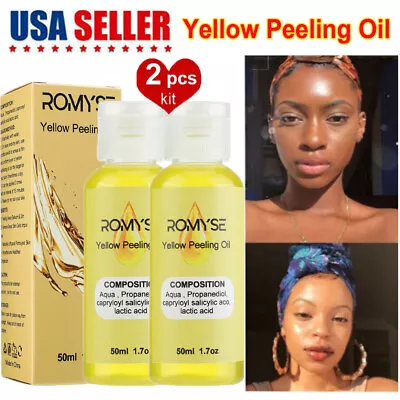 2X Yellow Peeling Oil Face Body Skin Lighten Dark Spots Acne Melanin Peeling Oil • $11.78