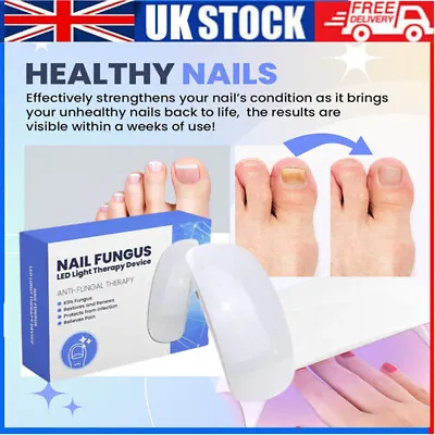Nail Fungus Laser-Device Light Therapy Onychomycosis Toes Treatment Household A+ • £6.99