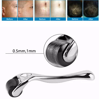 540 Titanium Micro Derma Roller 1.0 Mm For Acne Scars WrinklesBeard Hair Loss. • $13.54