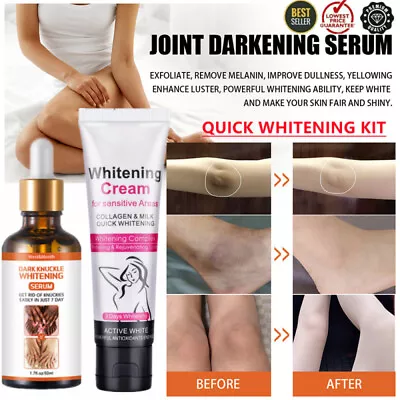 Dark Skin Permanent Whitening Cream 3DAYS Body Bleaching Lightening Brightening • £8.95