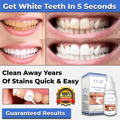 New Instant Tooth Whitening Kit White Teeth Clean Gel Uv Bleach Dental Strength • $24.95